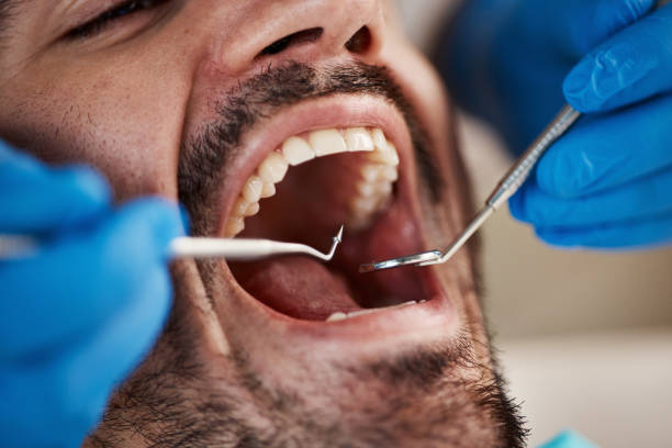 Best Urgent Tooth Repair  in Southfield, MI